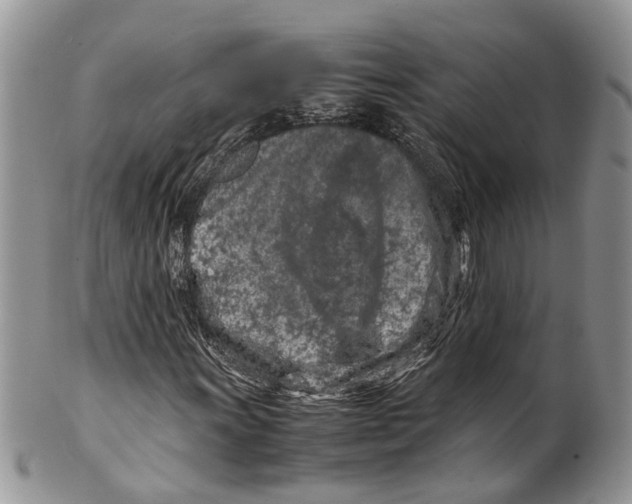 X0000099511011200806051142