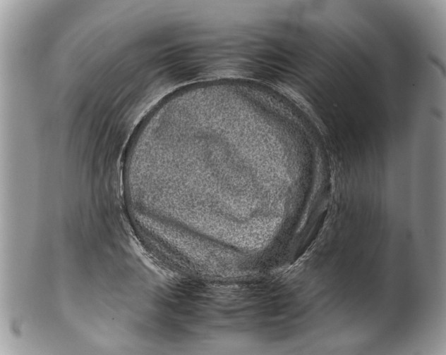 X0000099511031200806051142