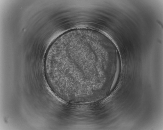 X0000099511045200806051142