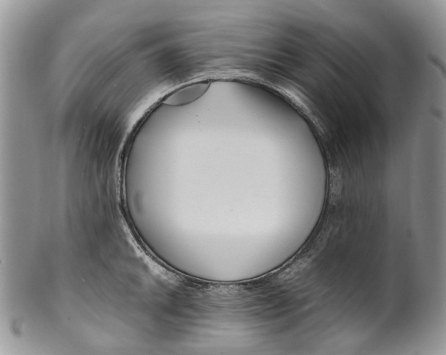 X0000099511046200806051142