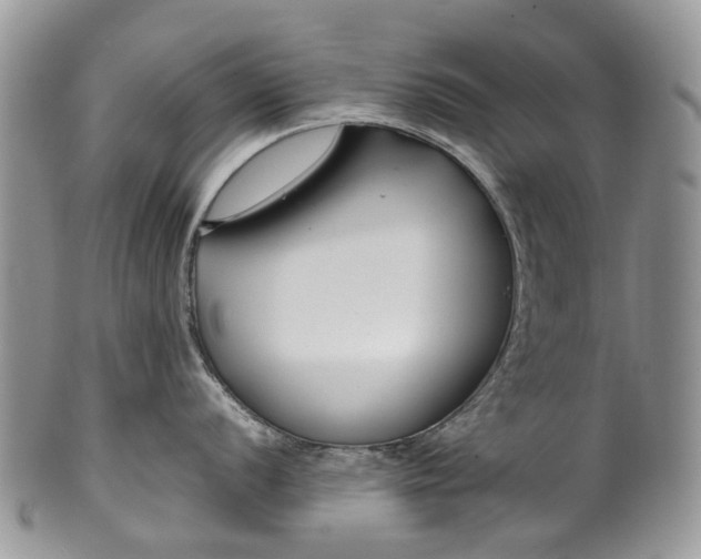 X0000099511056200806051142