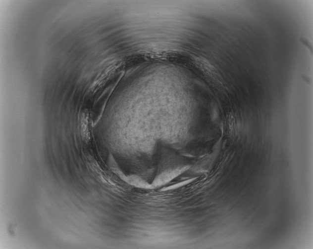 X0000099511060200806051142