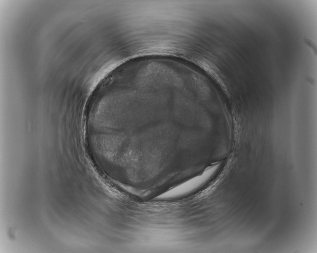 X0000099511077200806051141