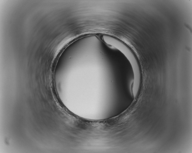 X0000099511085200806051141