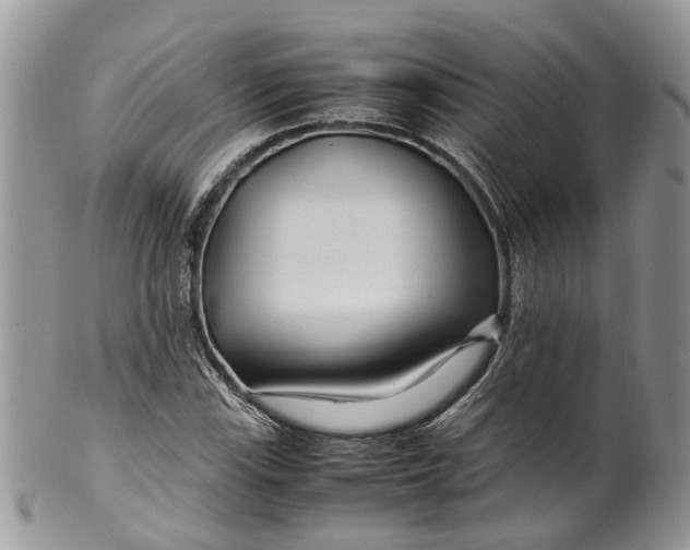 X0000099511115200806051140