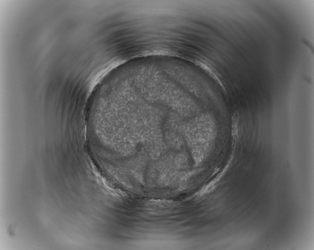 X0000099511117200806051140