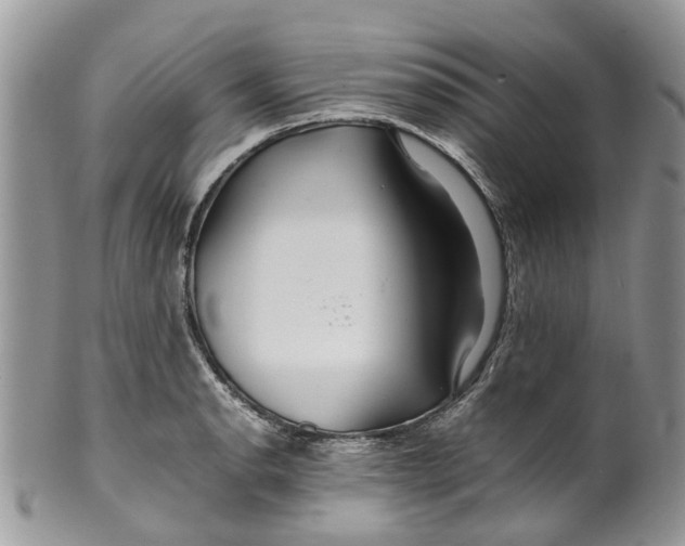 X0000099511134200806051141