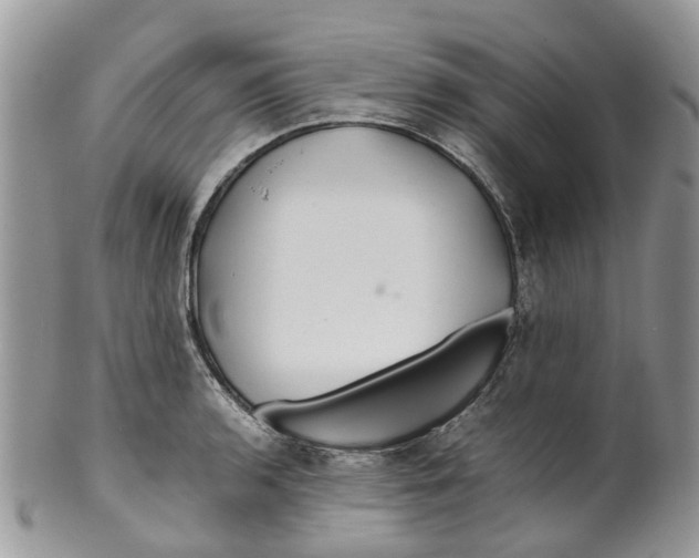 X0000099511136200806051141