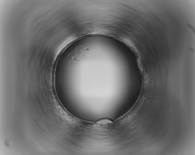 X0000099511138200806051141