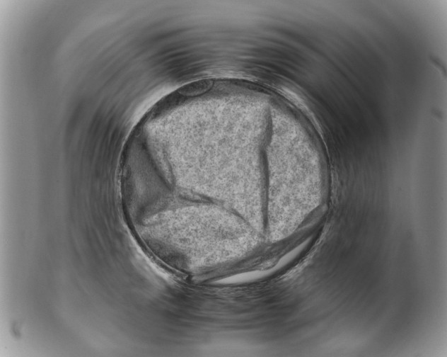 X0000099511141200806051141