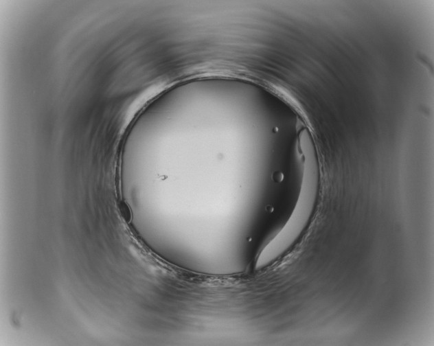 X0000099511146200806051141