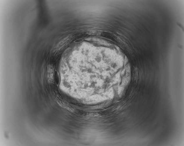 X0000099511154200806051140