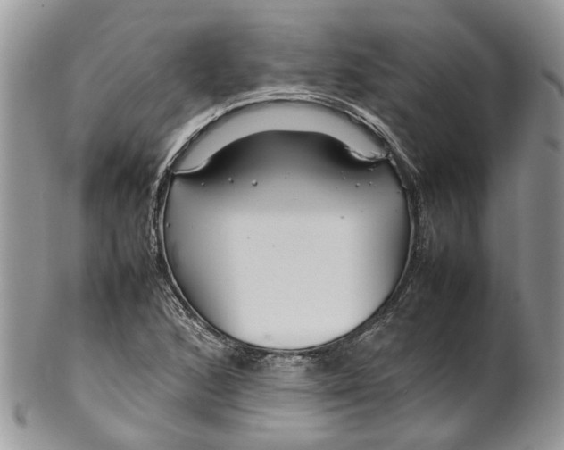 X0000099511168200806051140