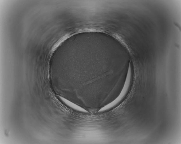 X0000099511173200806051140