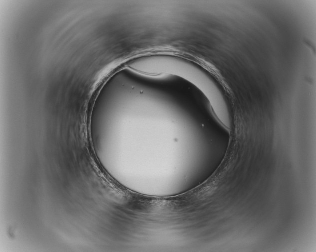 X0000099511176200806051140