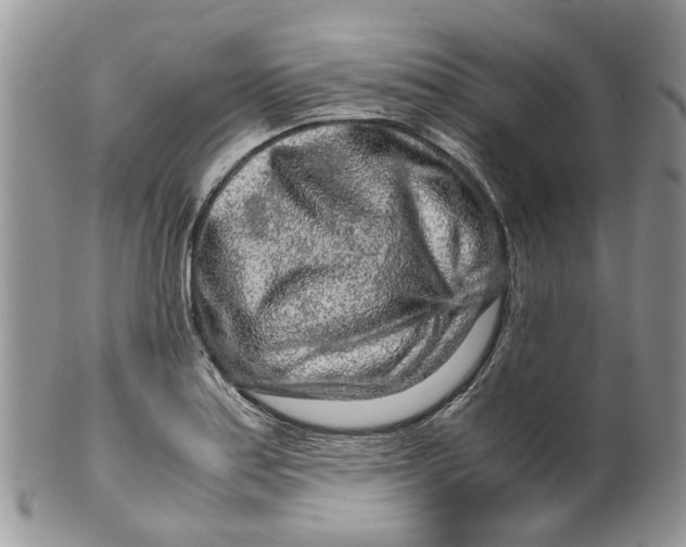 X0000099511179200806051140