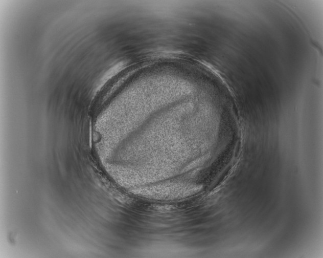 X0000099511219200806051139