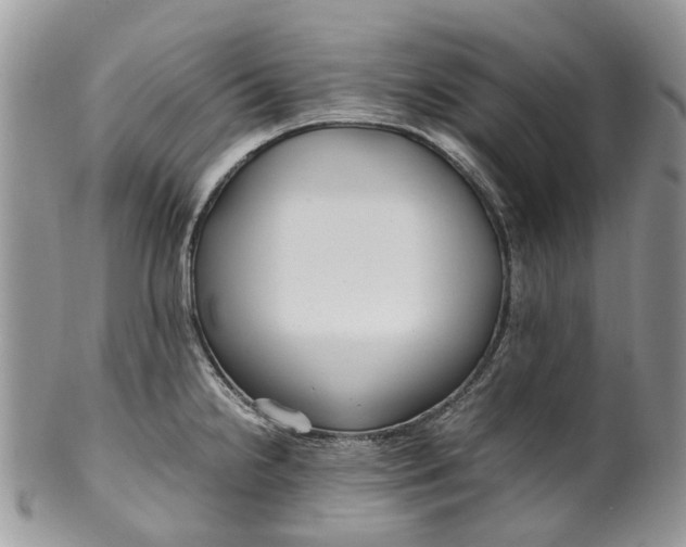 X0000099511238200806051139