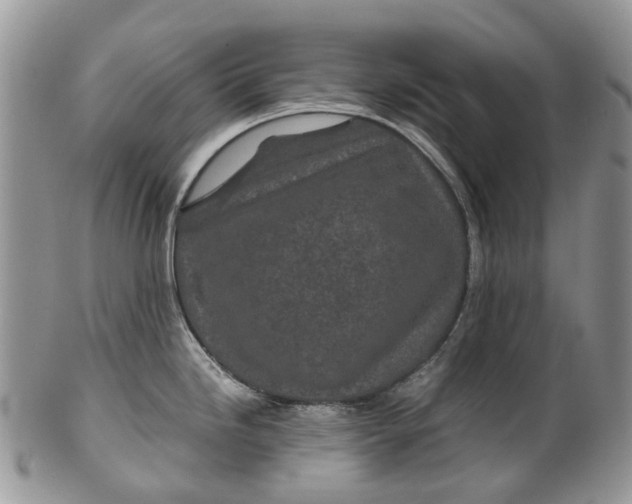 X0000099511246200806051139