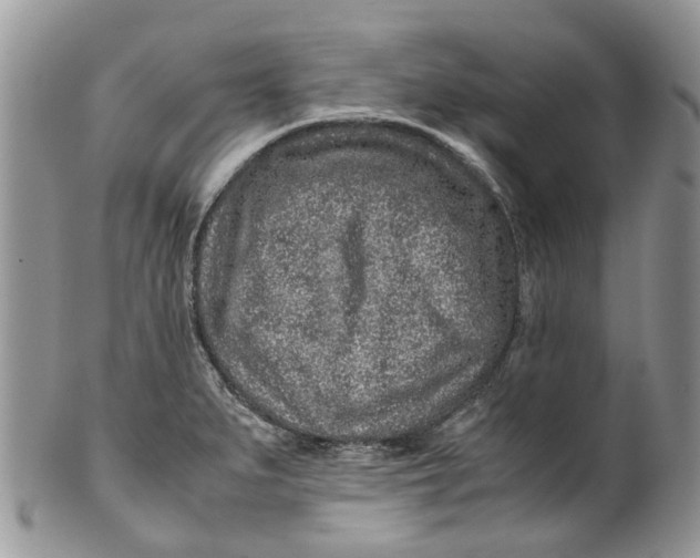 X0000099511279200806051138