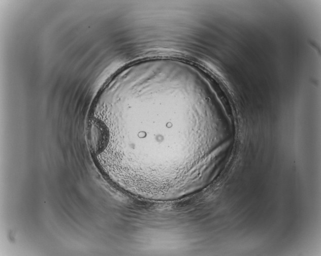 X0000099511283200806051138