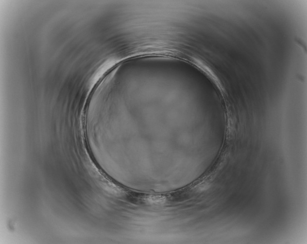 X0000099511291200806051138