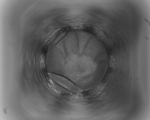 X0000099511298200806051137