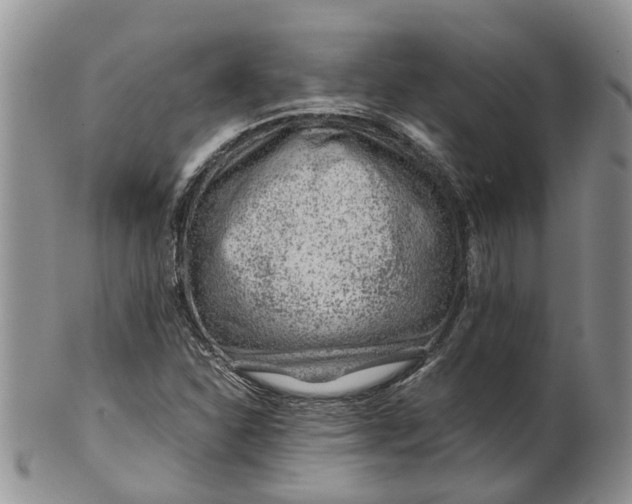 X0000099511310200806051137