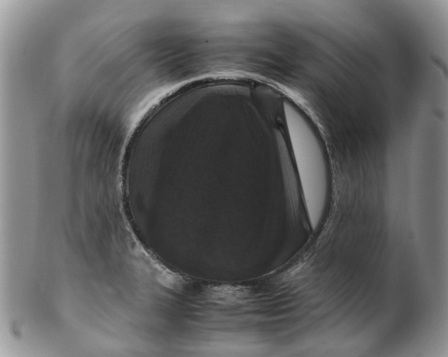 X0000099511327200806051137