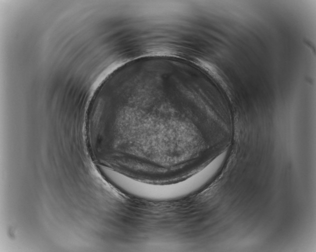 X0000099511331200806051138