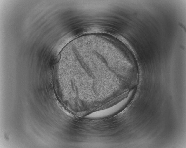 X0000099511337200806051138