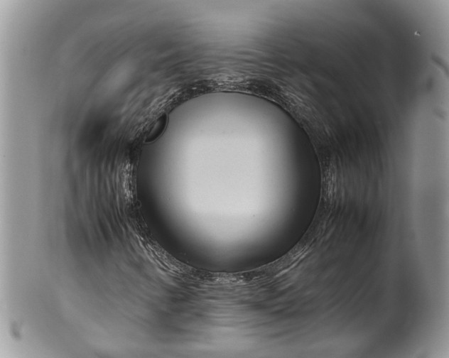 X0000099511346200806051137