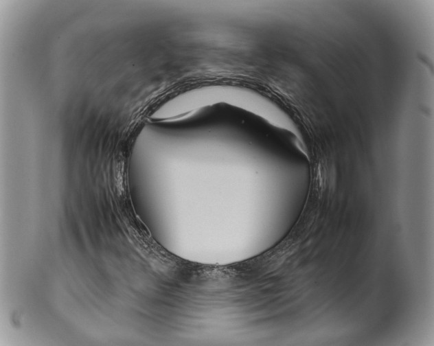 X0000099511348200806051137