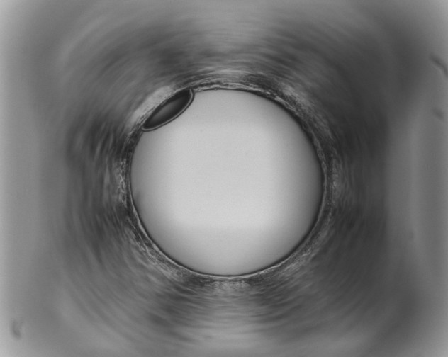 X0000099511354200806051137