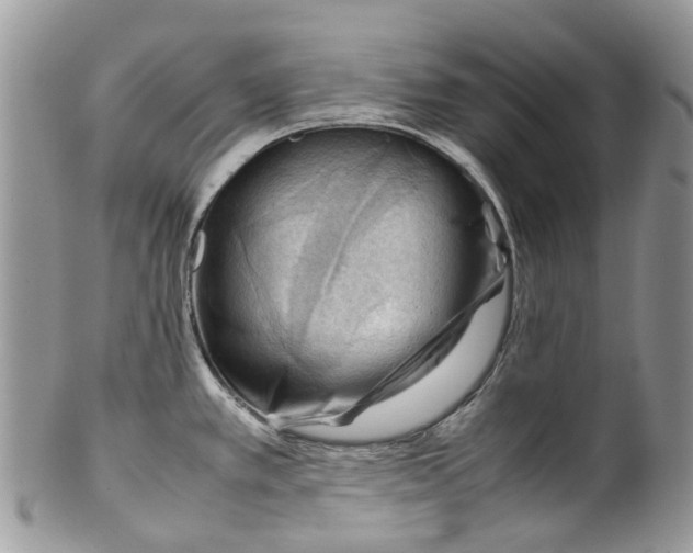 X0000099511389200806051136