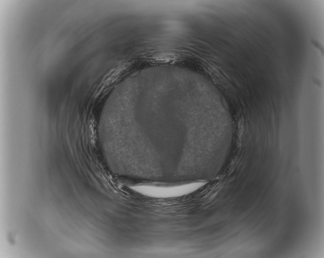 X0000099511394200806051136