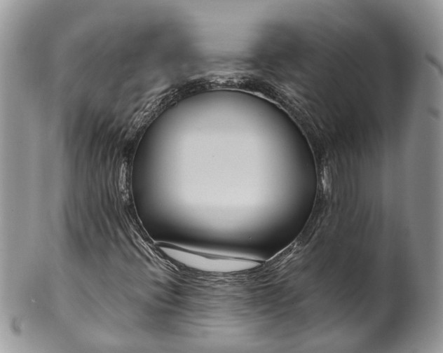 X0000099511396200806051136