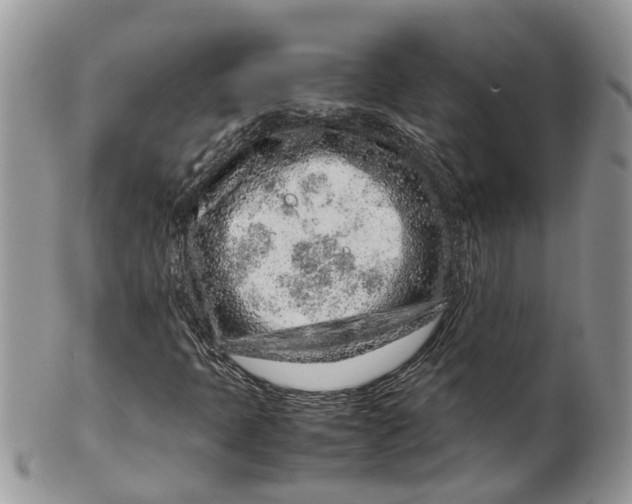 X0000099511397200806051136