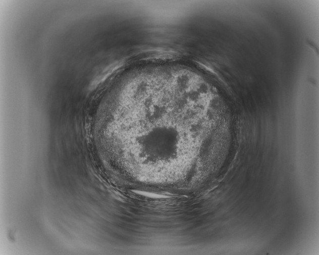 X0000099511399200806051136