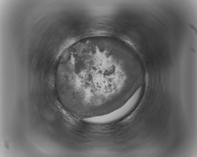 X0000099511405200806051136