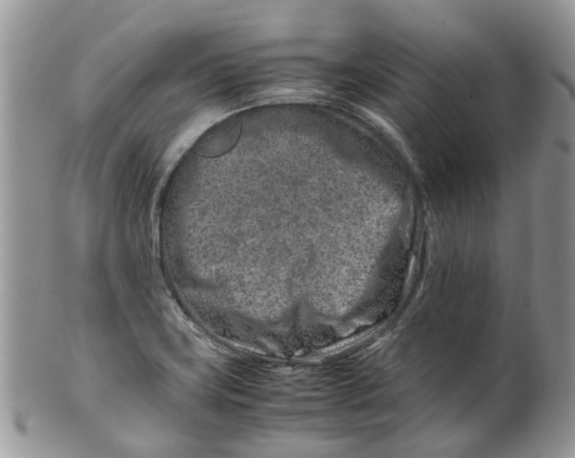 X0000099511419200806051136