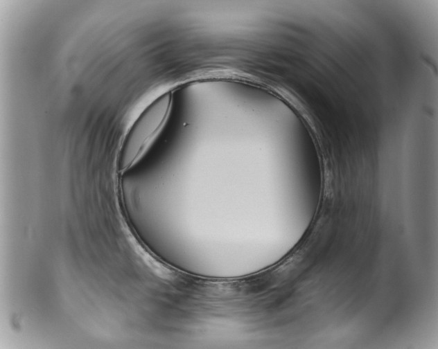 X0000099511438200806051136