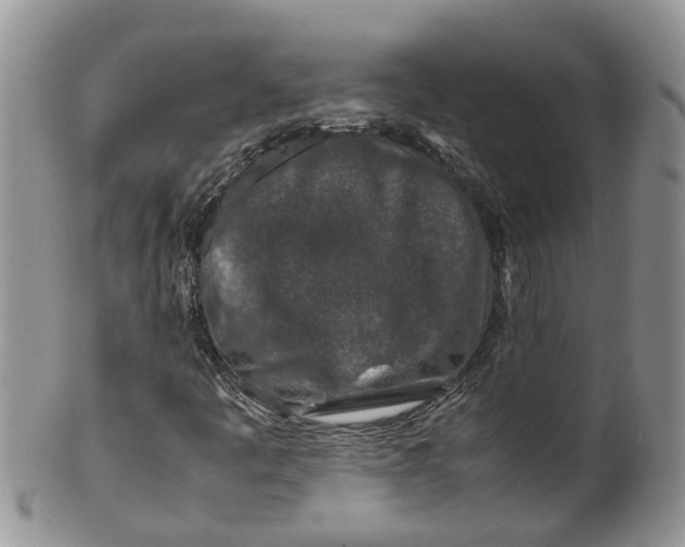 X0000099511445200806051135