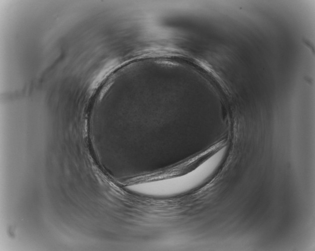 X0000099511459200806051135