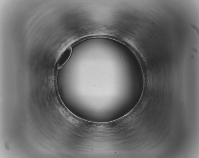 X0000099511460200806051135