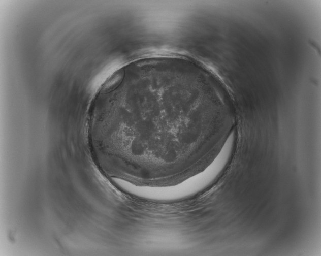 X0000099511463200806051135