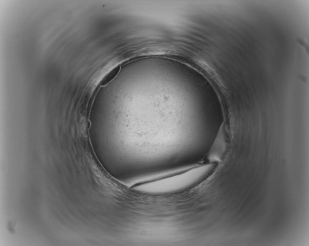 X0000099511465200806051135