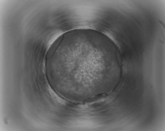 X0000099511468200806051135