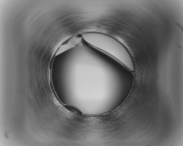 X0000099511476200806051135