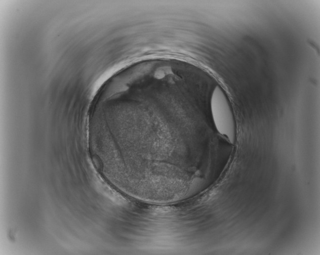 X0000099511522200806051134